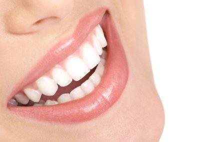 sonrisa1